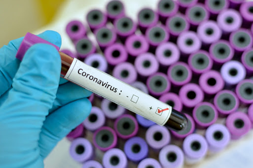 Coronavirus, record positivo, mai così pochi decessi