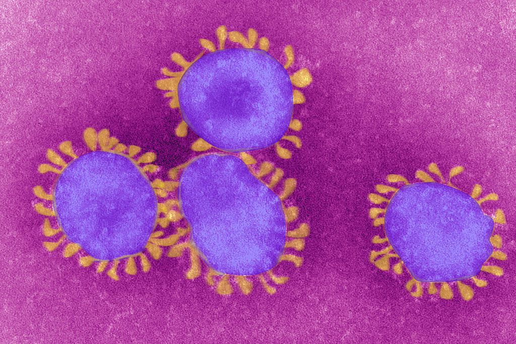 Coronavirus, in Campania il 41% in più di contagi (ma solo perché è riferito a due giorni fa)